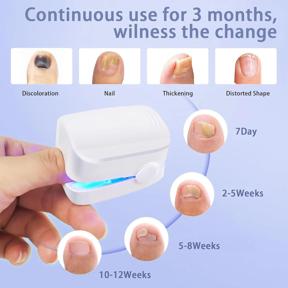 Light-Activated Nail Care Device for Fingernails and Toenails - Image 4