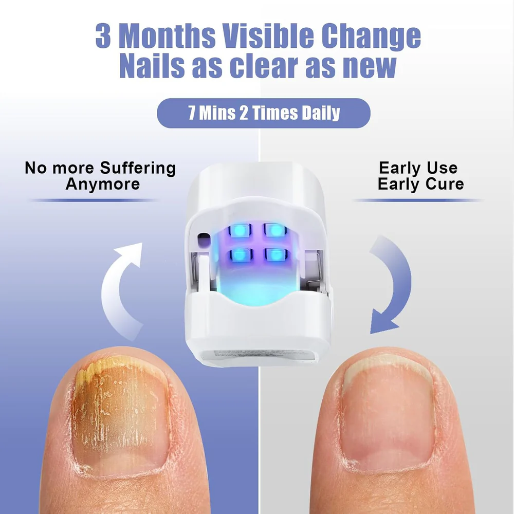Light-Activated Nail Care Device for Fingernails and Toenails - Image 3